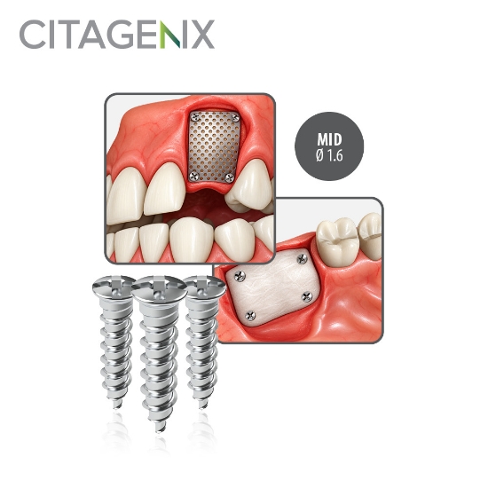 Picture of MID Ø 1.6 - Titanium Screws