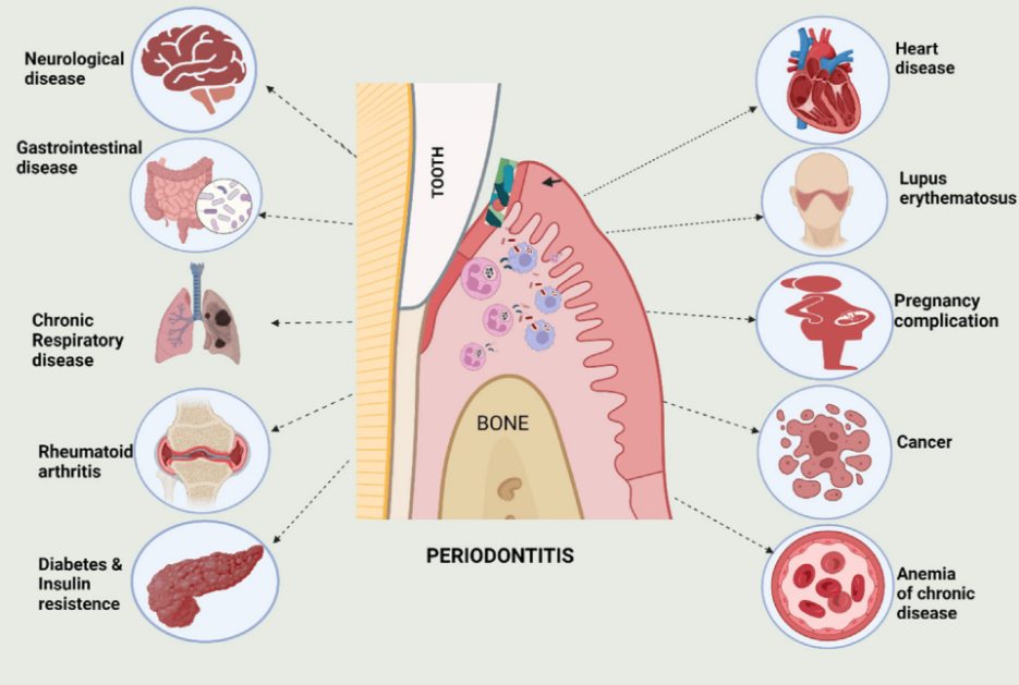 PERIODONTAL HEALTH ISSUE | JULY 2024