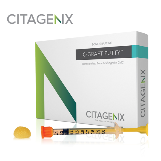 Picture of C-Graft Putty™